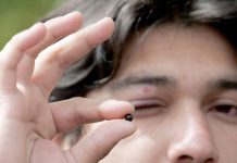 Región de Coquimbo «contribuye» con 8 casos de los 230 en el país de personas con daño ocular