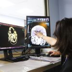 Scanner a 48 años de historia: el legado del Servicio de Neurología y Neurocirugía del Hospital de Coquimbo