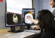 Scanner a 48 años de historia: el legado del Servicio de Neurología y Neurocirugía del Hospital de Coquimbo
