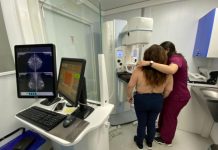 Coquimbo ofrece 108 mamografías gratuitas para prevenir el cáncer